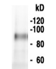 MEB2 | Membrane protein of ER body 2 in the group Antibodies Plant/Algal / Membrane Transport System / Endomembrane system at Agrisera AB (Antibodies for research) (AS20 4422)